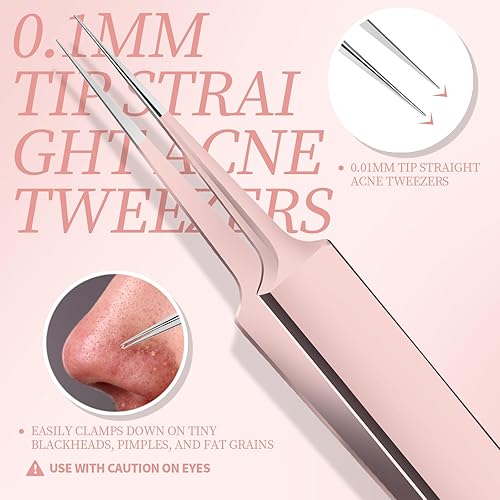 Miniatura 4 de Teenitor Kit de eliminación de puntos negros, kit de herramientas para reventar espinillas, 2 extractores de puntos negros, 1 pinzas de pelo