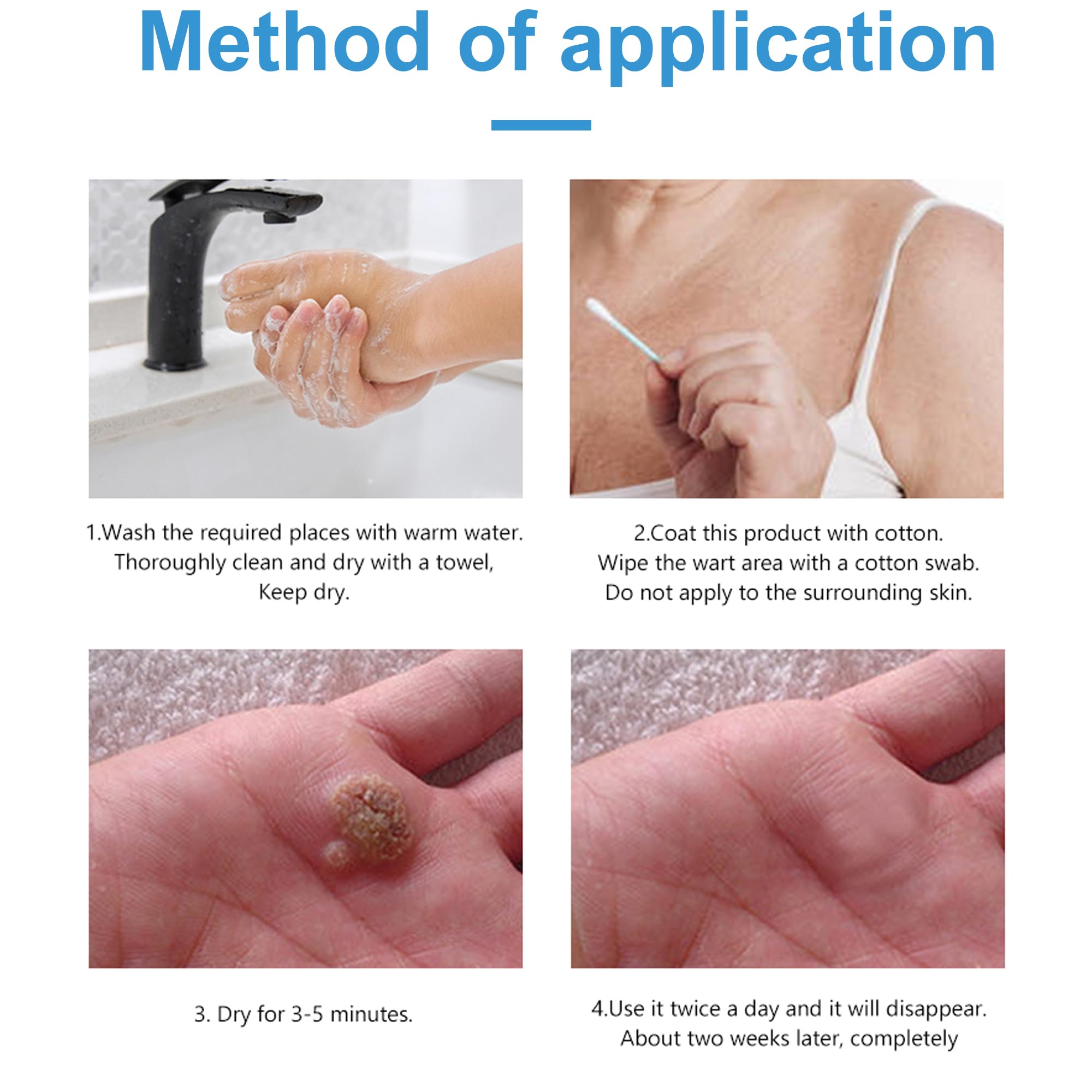 Wart Remover Cream 20g, Skin-Tag-Remover-Kit for Face & Body, Gentle Removal for Common Warts, Plantar warts, Corns — view 6
