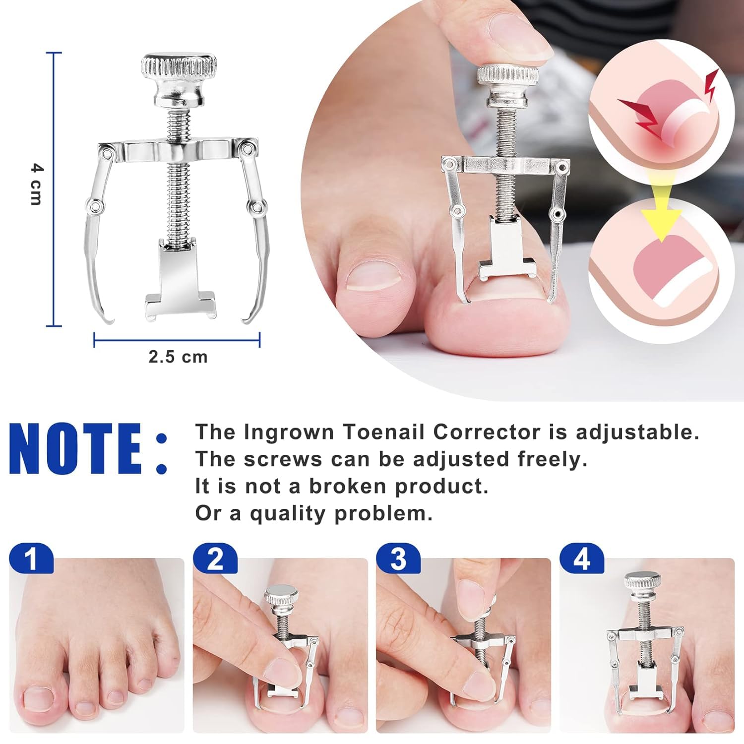 kit de Traitement des Ongles Incarnés – Pince à Ongles Incarnés et Outils de Correction avec Instruments en Acier Inoxydable