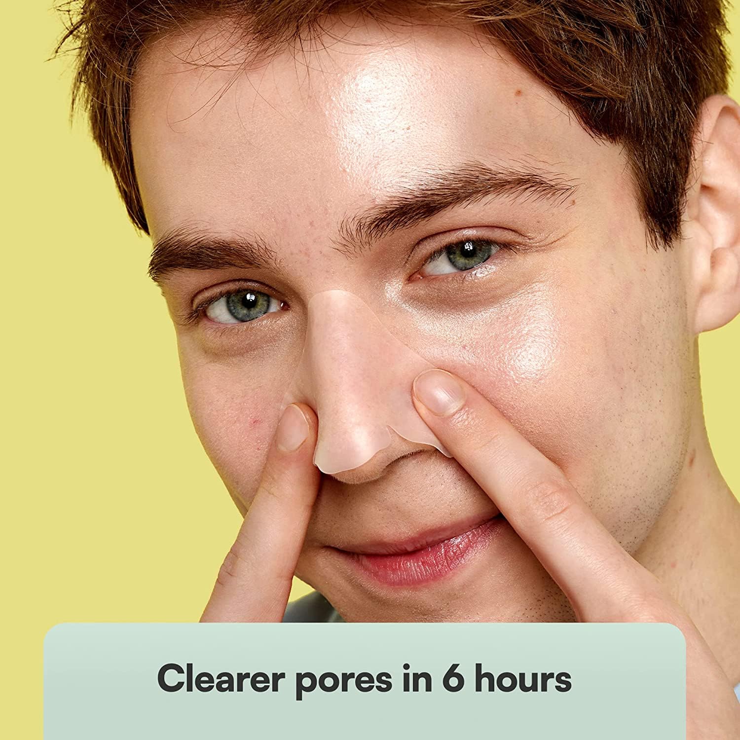 SKIN CHOICE Nose Pore Strips - Strisce idrocolloidali per la pulizia profonda per liberare e restringere i pori, assorbire il sebo, acne e punti neri Vegan (5 unità)