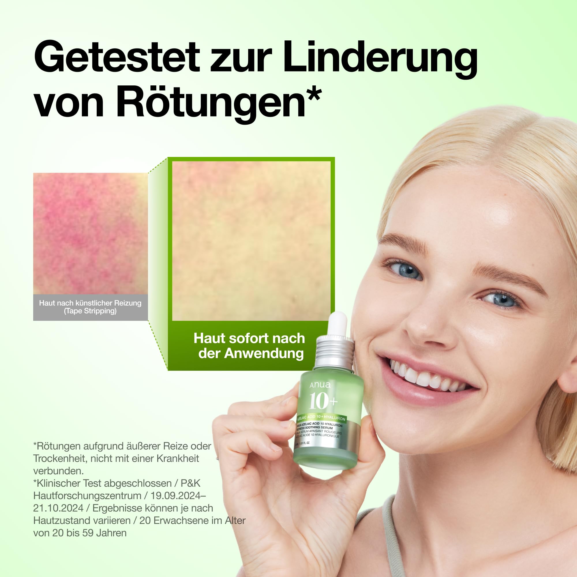 Anua Azelaic Acid 10 Hyaluron Redness Soothing Serum, Gesichtsserum für unreine & empfindliche Haut, Leichte & hydratisierende Hautpflege bei Unreinheiten, Hyaluronserum, Korean Skincare, 30ml