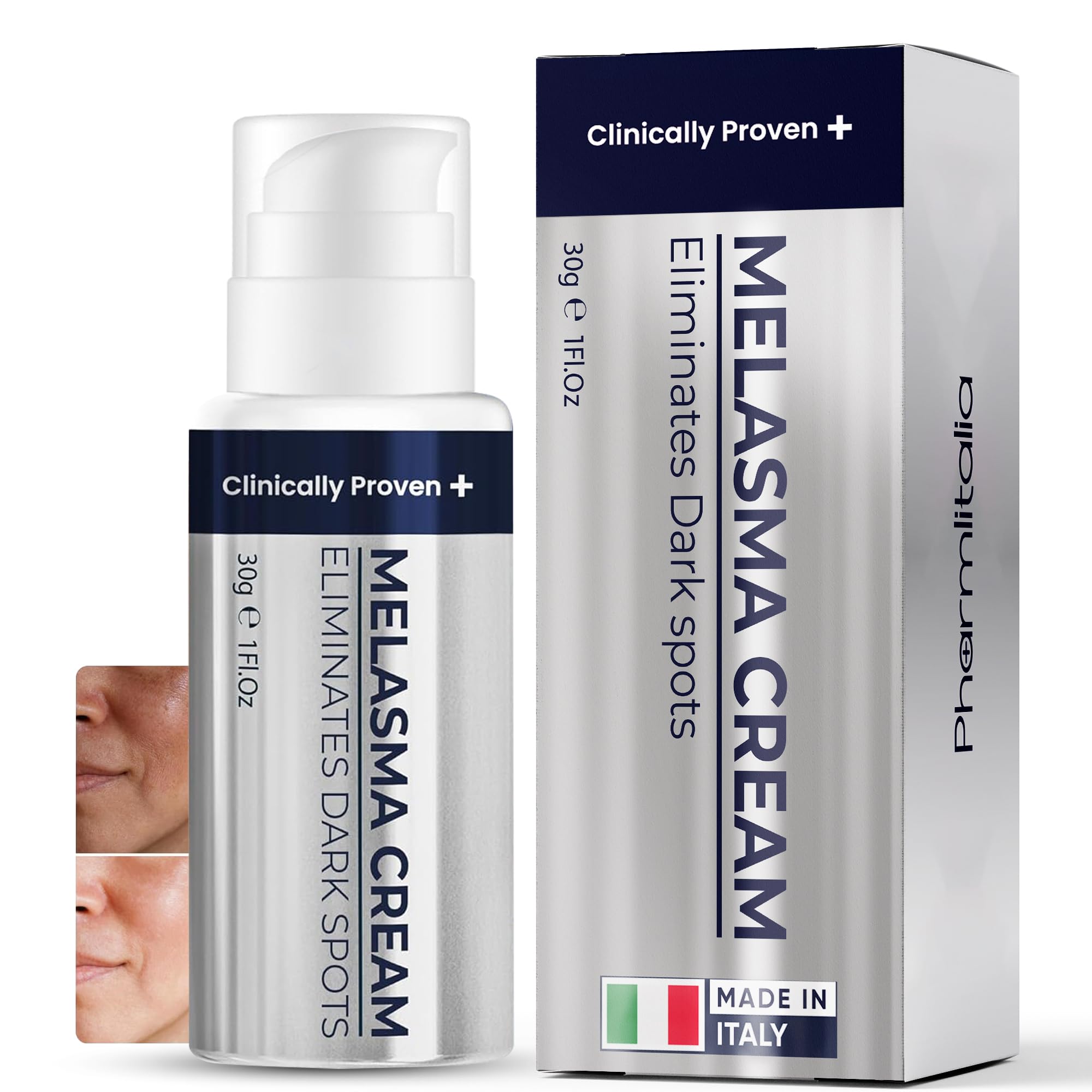 Melasma Treatment for Face - Melasma Cream & Age Spot Remover for Skin Discoloration, Post-Blemish Marks, Scars & Spots | Dark Spot Remover for Face & Body