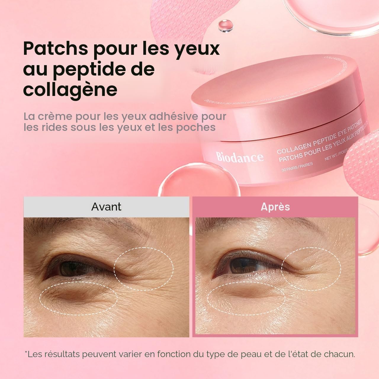 BIODANCE Collagen Peptide Under Eye Patches, Patchs Yeux Hydrogel aux Peptides de Collagène, Pour Cernes, Poches et Ridu — vue 2