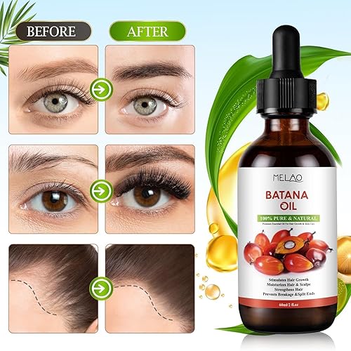 Miniatura 4 de Aceite de batana para el crecimiento del cabello 100% puro y natural, elimina las puntas abiertas, mejora el brillo del cabello y la piel, nutre el