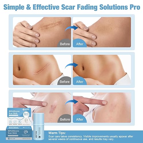 Miniatura 4 de Barra de silicona para cicatriz, 80% silicona para cara y cuerpo. Barra de silicona para eliminar cicatrices quirúrgicas, antiguas y recientes y