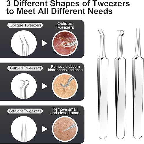 Miniatura 3 de Juego de herramientas de extracción y extracción de espinillas y acné de acero inoxidable, elimina rápida y de forma segura el acné, puntos negros,