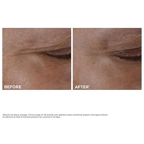 Miniatura 5 de Clarins NUEVO Total Eye Lift Crema antienvejecimiento para ojos Se dirige a arrugas, patas de gallo, ojeras e hinchazón para un levantamiento de