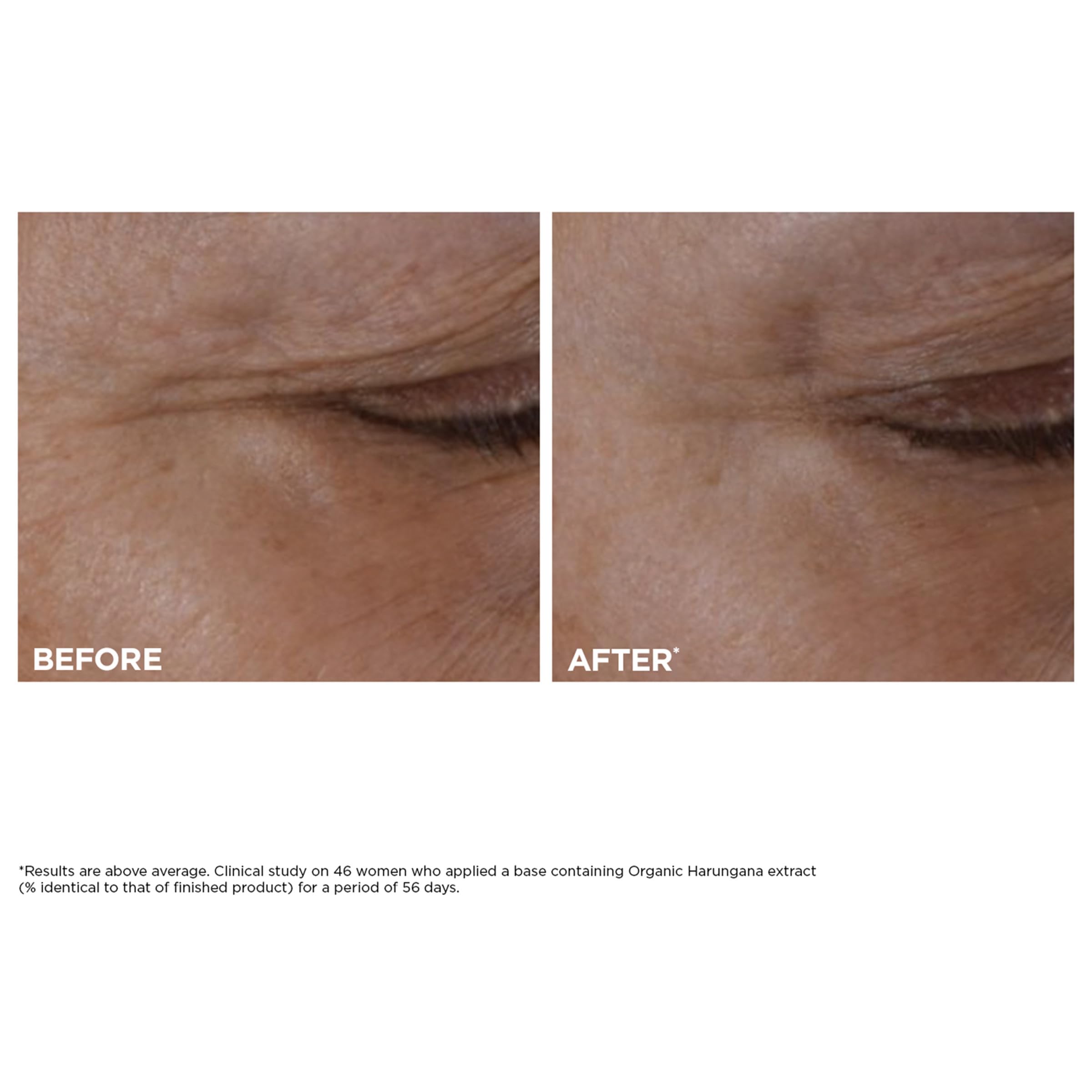 Clarins NEW Total Eye Lift | Anti Aging Eye Cream | Targets Wrinkles, Crow's Feet, Dark Circles and Puffiness For a Visible Eye Lift in 30 Seconds | REFILLABLE