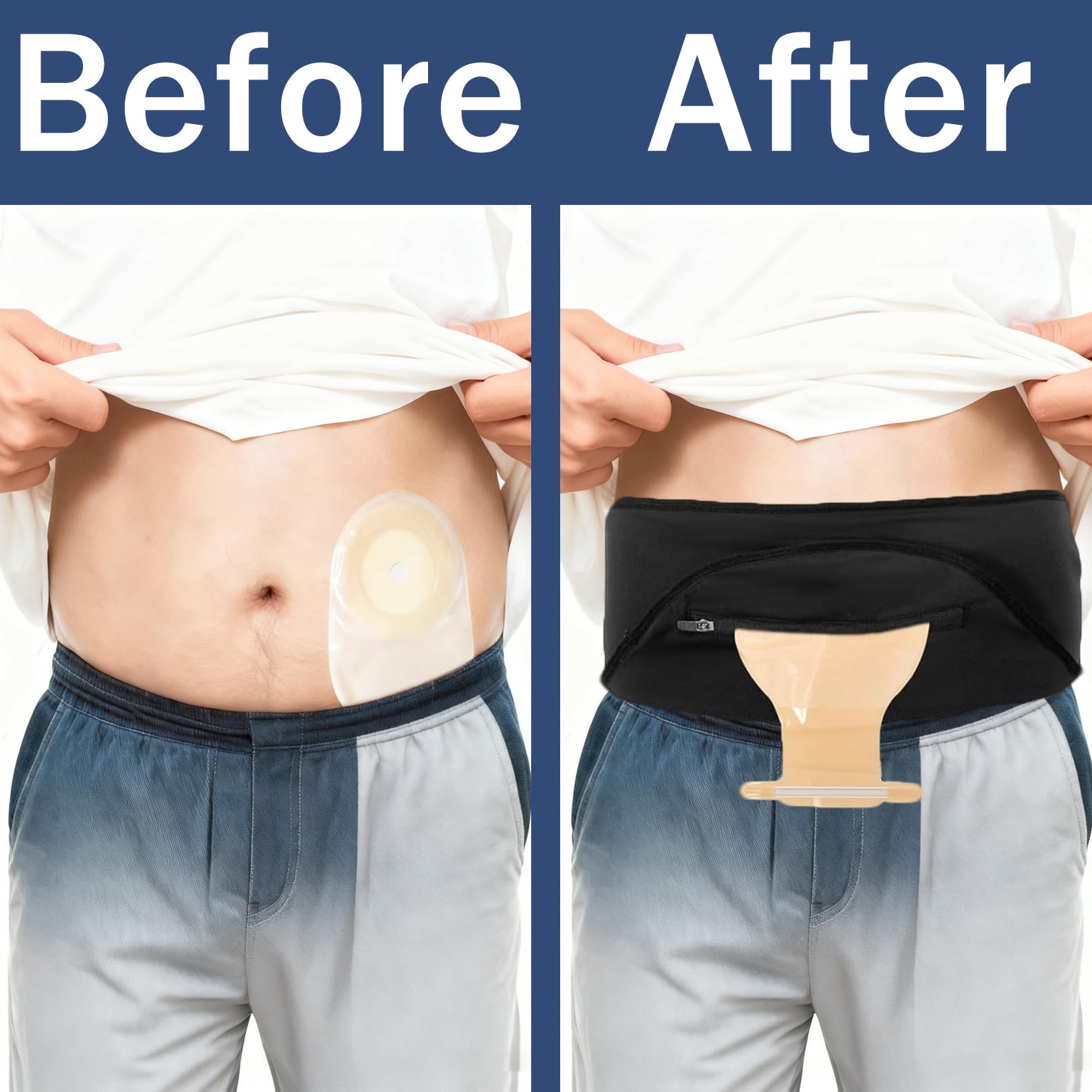 Cintura per stomia da uomo e donna, regolabile, per stomia e colostomia, cinture invisibili, cintura per la cura dell'ileostomia addominale, per sport, nuoto e attività all'aperto