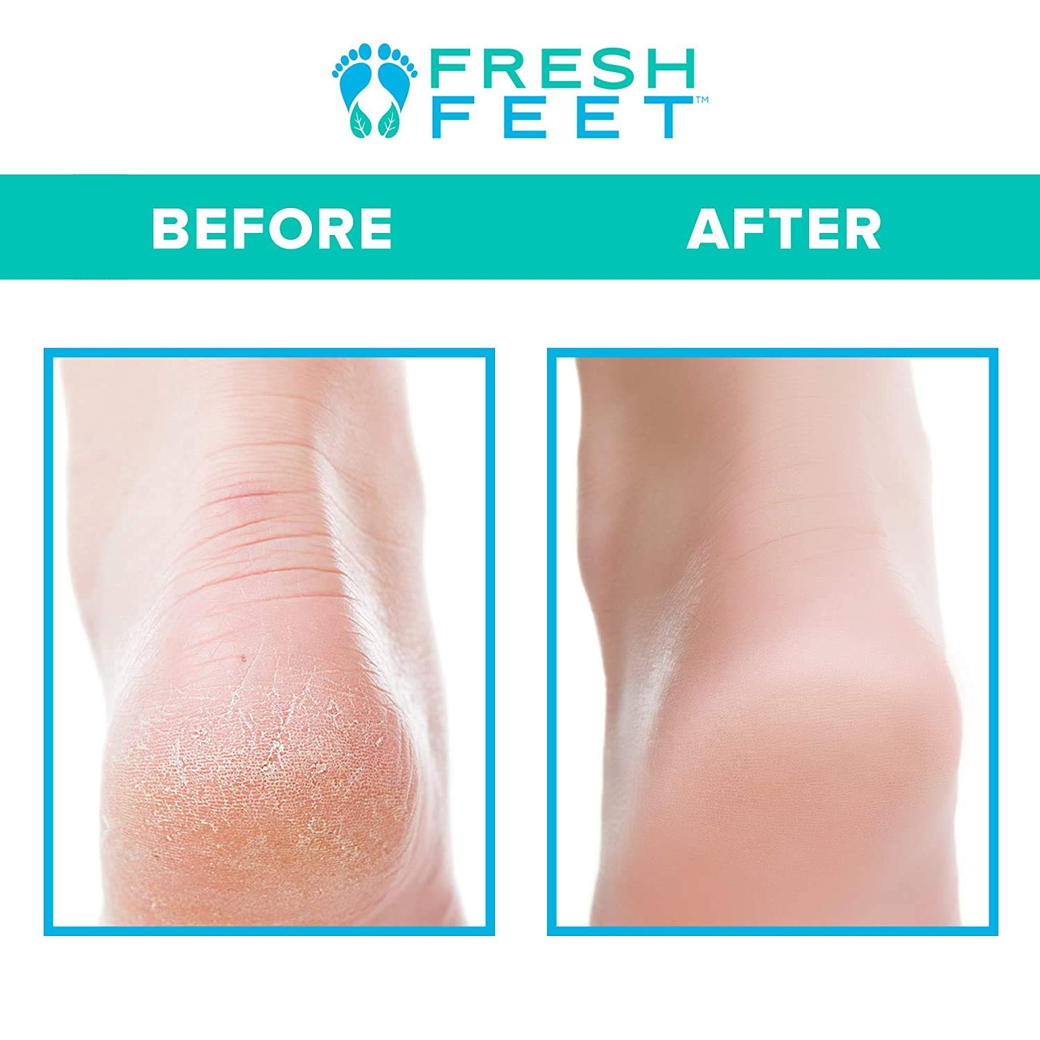 Fresh Feet Foot Scrubber with Built-In Pumice Stone