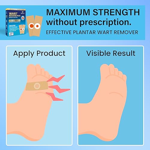 Miniatura 2 de Almohadillas eliminadoras de verrugas plantares Bandaid removedor de verrugas de ácido salicílico para verrugas plantares, verrugas de manos,