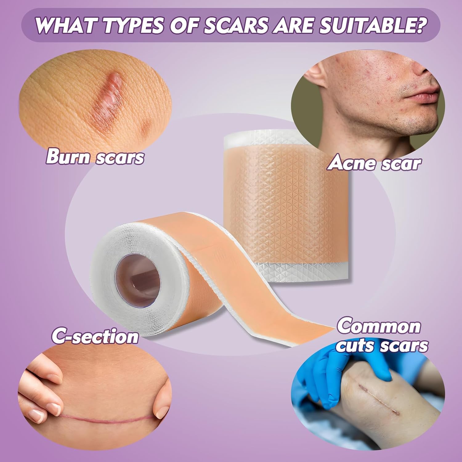 Rayyl Silicone Scar Sheets (1.6" x 60" Roll - 1.5M) - Advanced Silicone Scar Tape Roll Skin-Safe Flexible Strips for Smoother Looking Skin C-Section Recovery Everyday Scars Reusable Value Pack