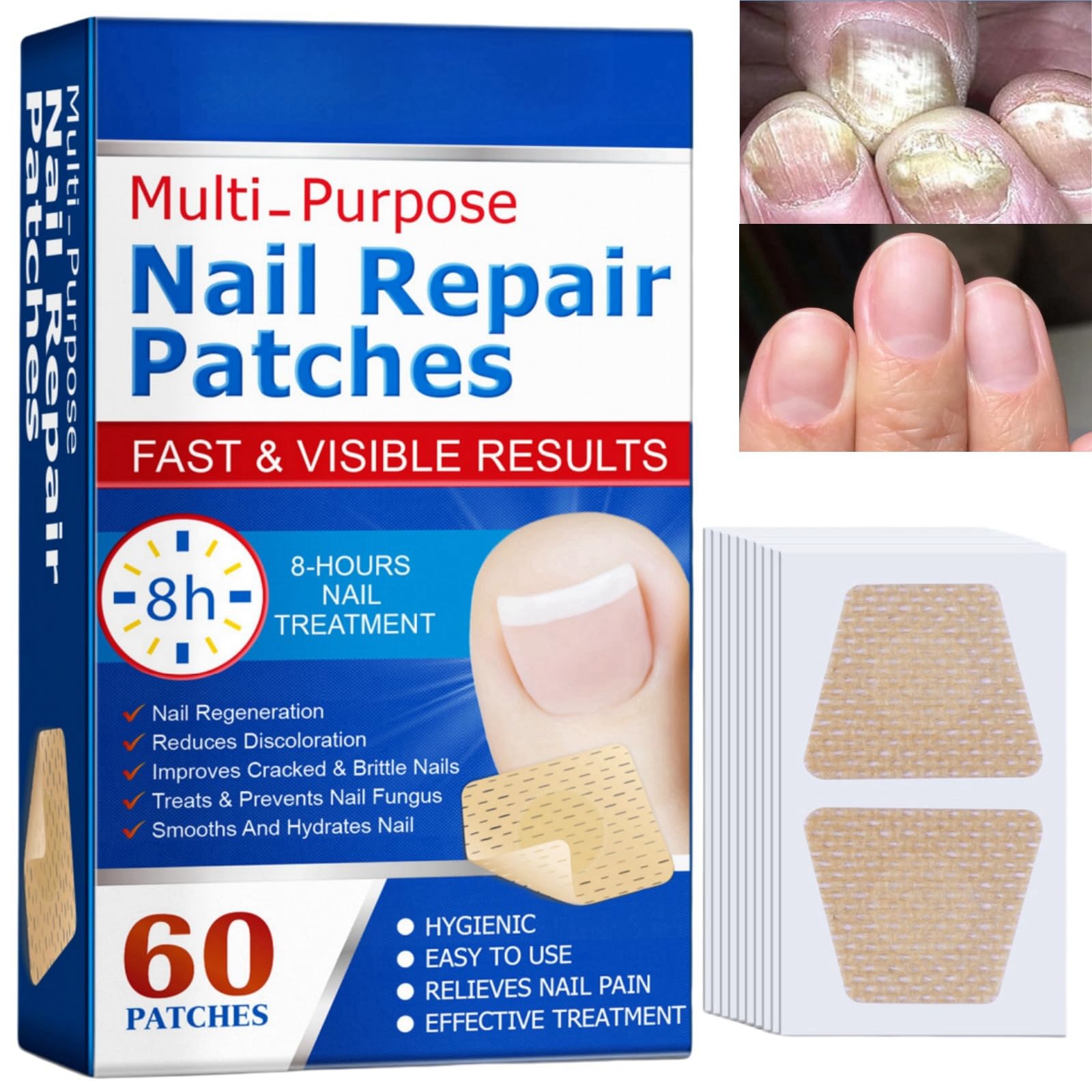 60pcs Nail Repair Patches,Fungal Nail Treatment,Keratin Nail Treatment,Nail Fungus Toenail Patches,Anti Fungal Toenail Treatment,Restores Healthy Nail,Extra Strong Nail Repair Treatment,Toenail Patche