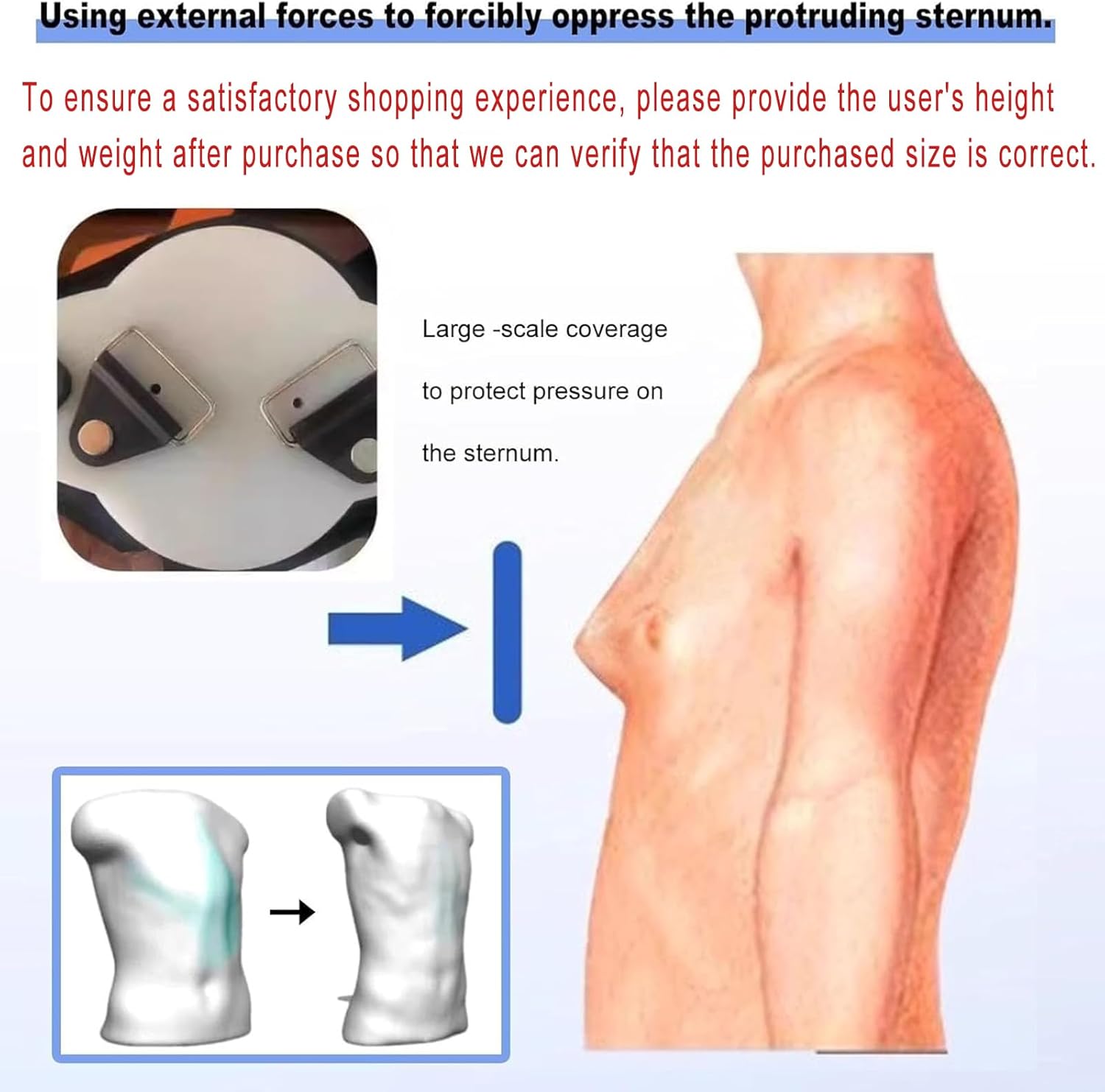 Adjustable Pigeon Chest Brace, Pigeon Chest Support, Thoracic Depression Brace, Skin-Friendly and Breathable, External Pressure Assistance & Will Not Move, for Correction, Day and Night Use