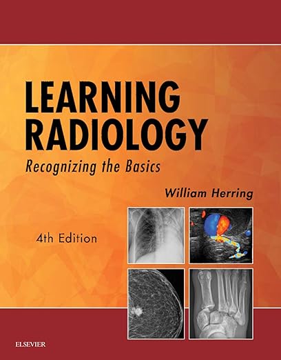 Ebook - Learning Radiology: Recognizing the Basics (PDF Instant Download)