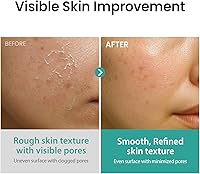 Vista 3 de coxir AHA + BHA - Tónico limpiador de poros para todo tipo de piel, purificante, AHA, BHA, cuidado diario de los poros, cuidado de la piel k Beauty