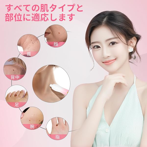 FERNIDA イボ取りフルセット イボ除去キット 88 回分バンド付 4 サイズ対応 全身ケア 片手操作 1 年超長持ち 日本語取扱説明書付 - 3