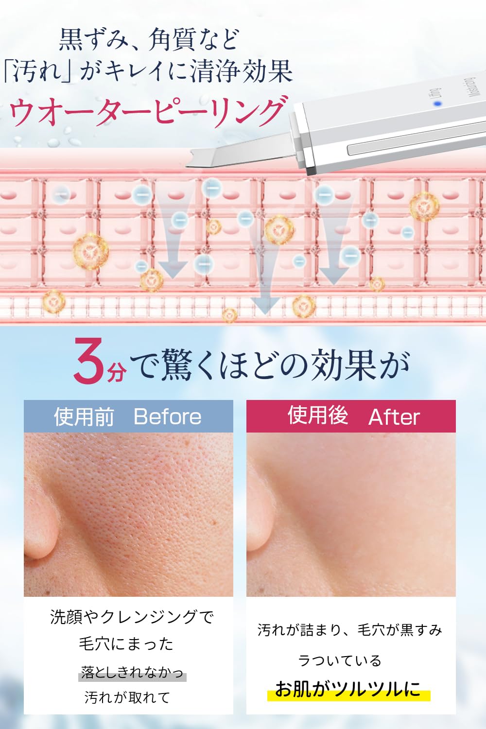 Amazon.co.jp: ウォーターピーリング 美顔器 【美顔スタッフのプロが