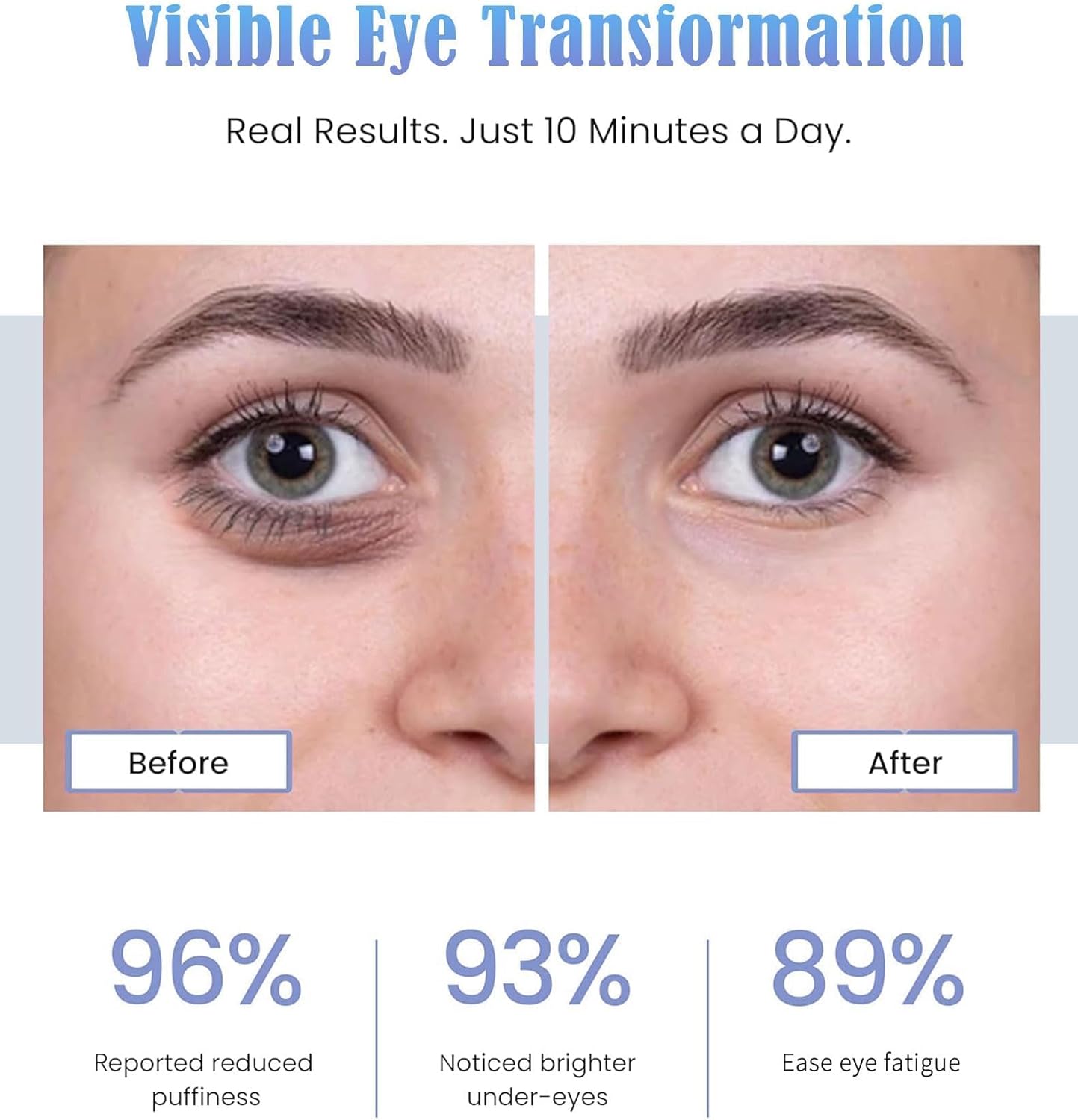 UTK Under-Eye Red Light Therapy Glasses for Women,Eye Massager for Dark Circles Eye Bags Puffiness Wrinkles Fine Lines,39g Ultra Lightweight, Rechargeable,Gift for Women Mom Girlfriend - Image 3