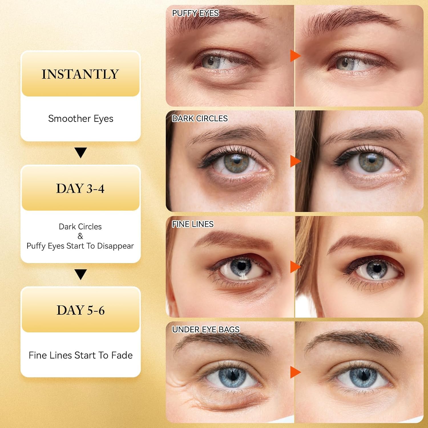 Netora Under Eye Patches 60 Pcs for Dark Circles & Puffy Eyes Collagen Amino Acid Hydrating Under Eye Gel Mask Anti-Wrinkle & Eye Bags Treatment for Women & Men 4
