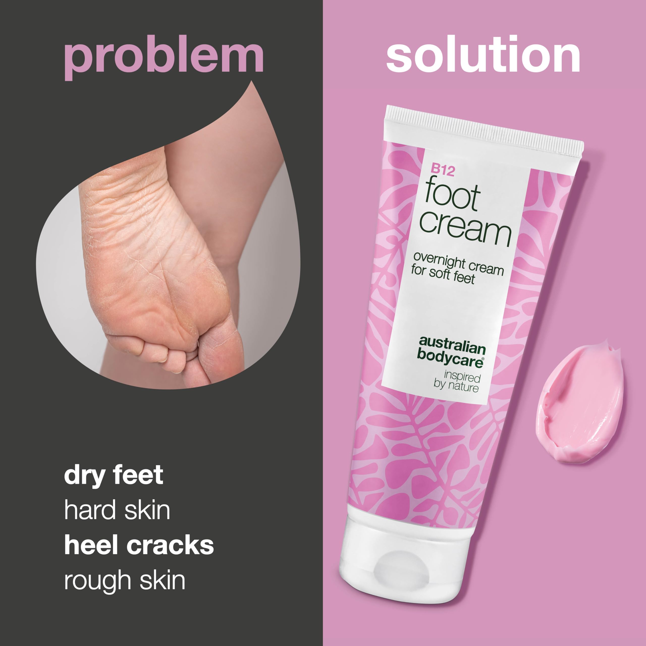 B12 Foot cream for cracked heels and hard skin, with Vitamin B12, 10% urea - Image 2