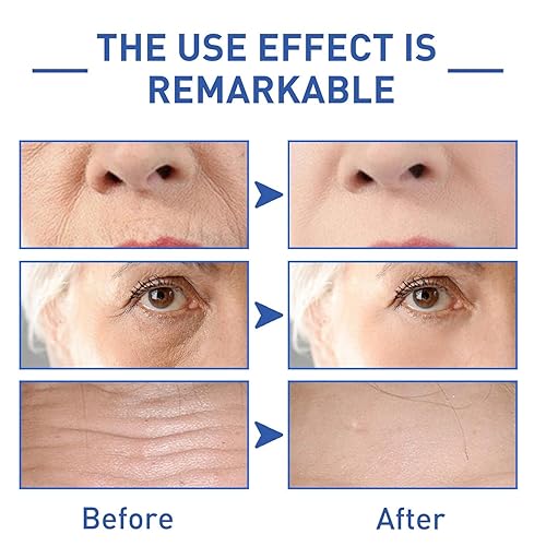 Miniatura 5 de Esencia de péptido Cono de 3 piezas, 84% de esencia de péptido Cono, extracto de planta pura esencia de suero facial, esencia hidratante