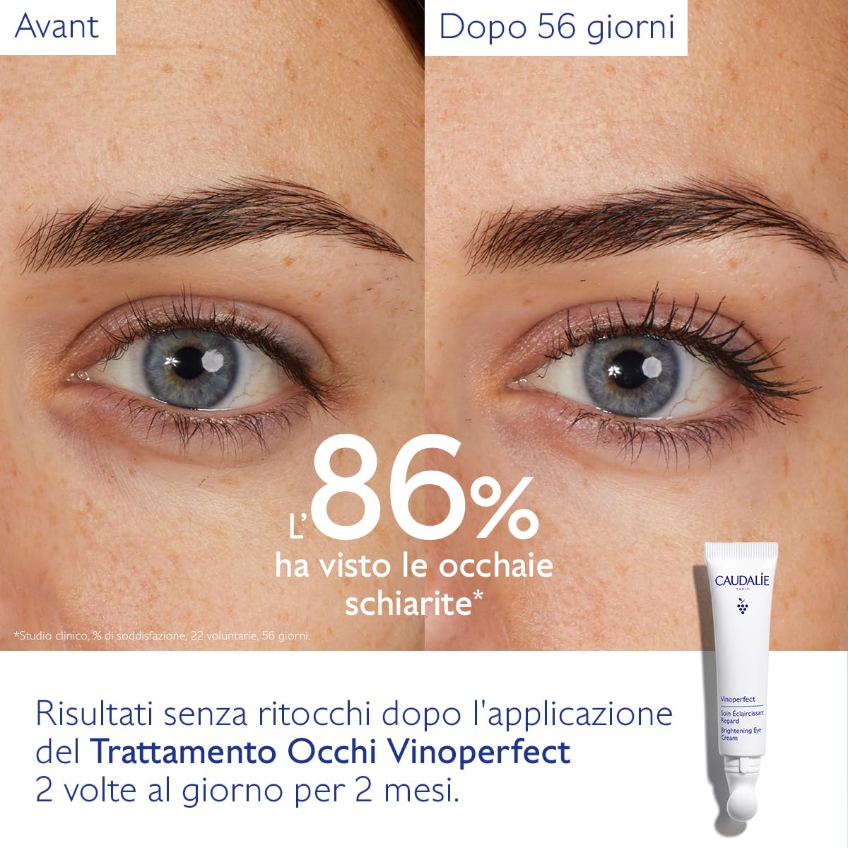 Caudalie Vinoperfect Trattamento Illuminante Occhi con Caffeina + Niacinamide - 15 mL