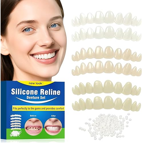 Veneers Teeth for Women, Tooth Replacement Missing Teeth, Upper Veneer Cosmetic, Moldable Thermal Beads Replacement Kit, Unisex to Temporary Tooth Repair Kit, 6PCS-001