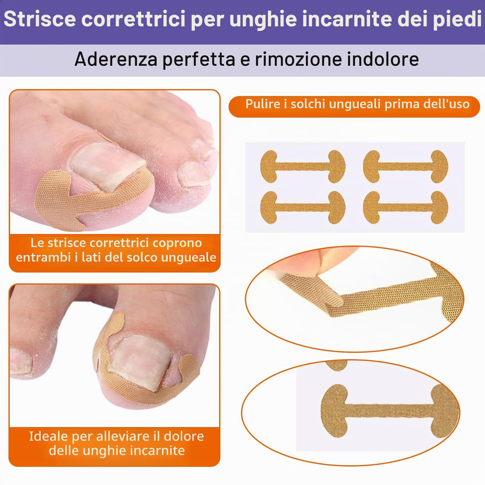 139 Pz Kit Trattamento Per Unghie Incarnite, Traspiranti Cerotti Per Unghie, Cuscinetti Di C Per Unghie Incarnite Piedi, Correzione Dell'Unghia Del Piede Incarnite Strumenti Professionali