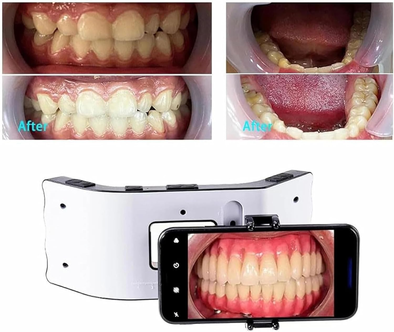 Dental Mobile Phone Fill Light, Dental Oral LED Photography Kits, 3 Group Lights Adjusted Independently & 3D Surround Lighting Design, for Home Salon and Macro Photography