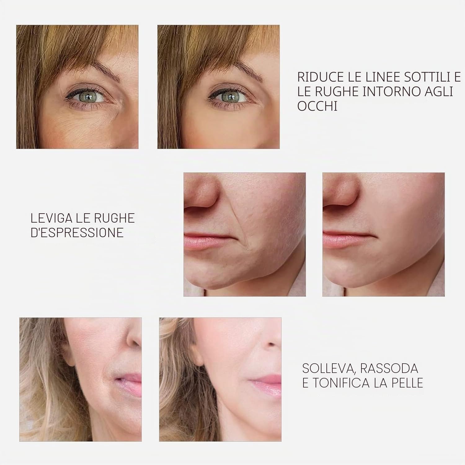 RF Radiofrequenza viso e corpo macchina rassodante – Professionale Home RF Lifting Skin Care Anti Aging Device – Effetti salone / più sicuro (bianco)