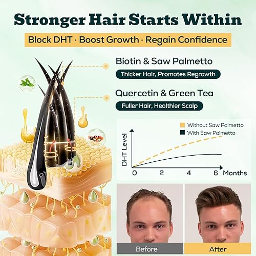 Miniatura 3 de Gomitas de Saw Palmetto para Hombres  Bloqueador DHT de Fuerza Extra de 600mg con Biotina, Semilla de Calabaza  Suplemento que Apoya la Función de