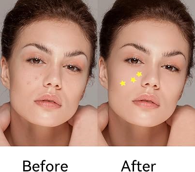 Stars Pimple Patches,32 PCS Light Hydrocolloid Acne Patches,Cute Face Spot Cover and Skin Care for Women Girls Men Boys