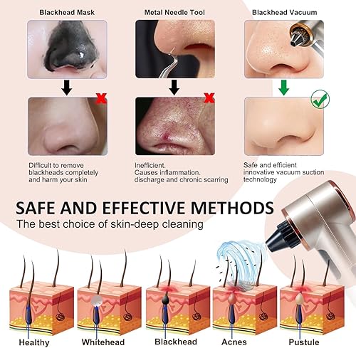 Miniatura 4 de Aspiradora removedor de puntos negros con calefacción, extractor de puntos negros, 3 niveles de succión ajustables, 9 modos