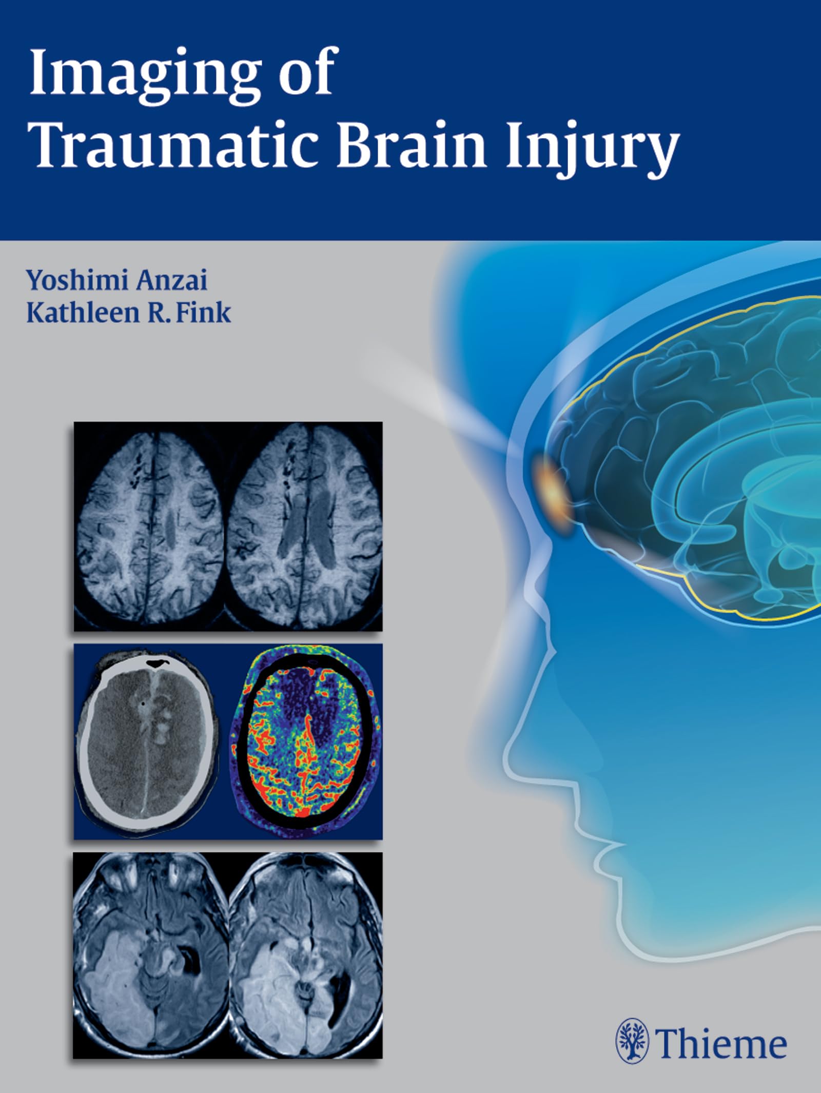 Buy Imaging of Traumatic Brain Injury — BookShops.in