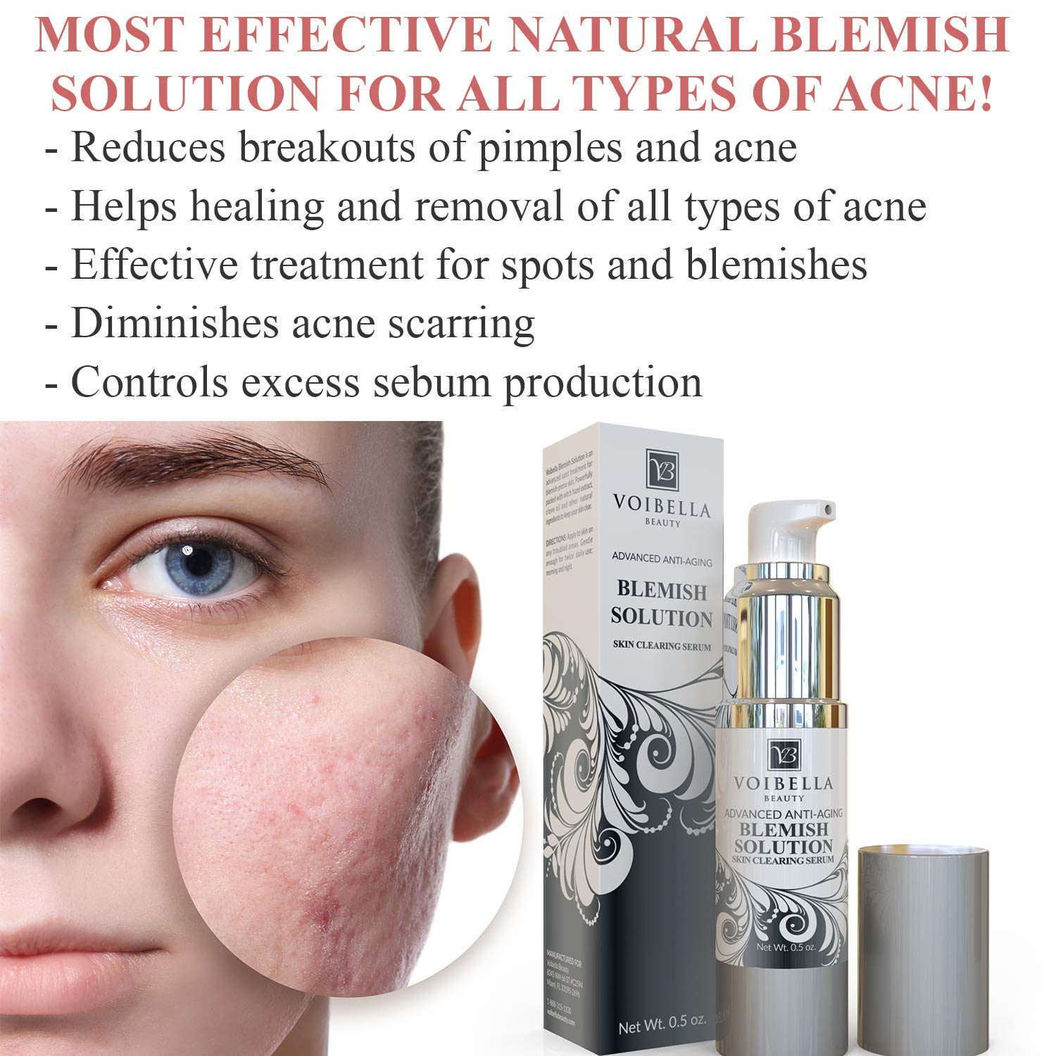 Best Blemish Remover & Anti Acne Spot Treatment Cream - Natural Dark Spot and Breakout Treatment Serum to Reduce Cystic Acne, Pimples, Blemishes and ...