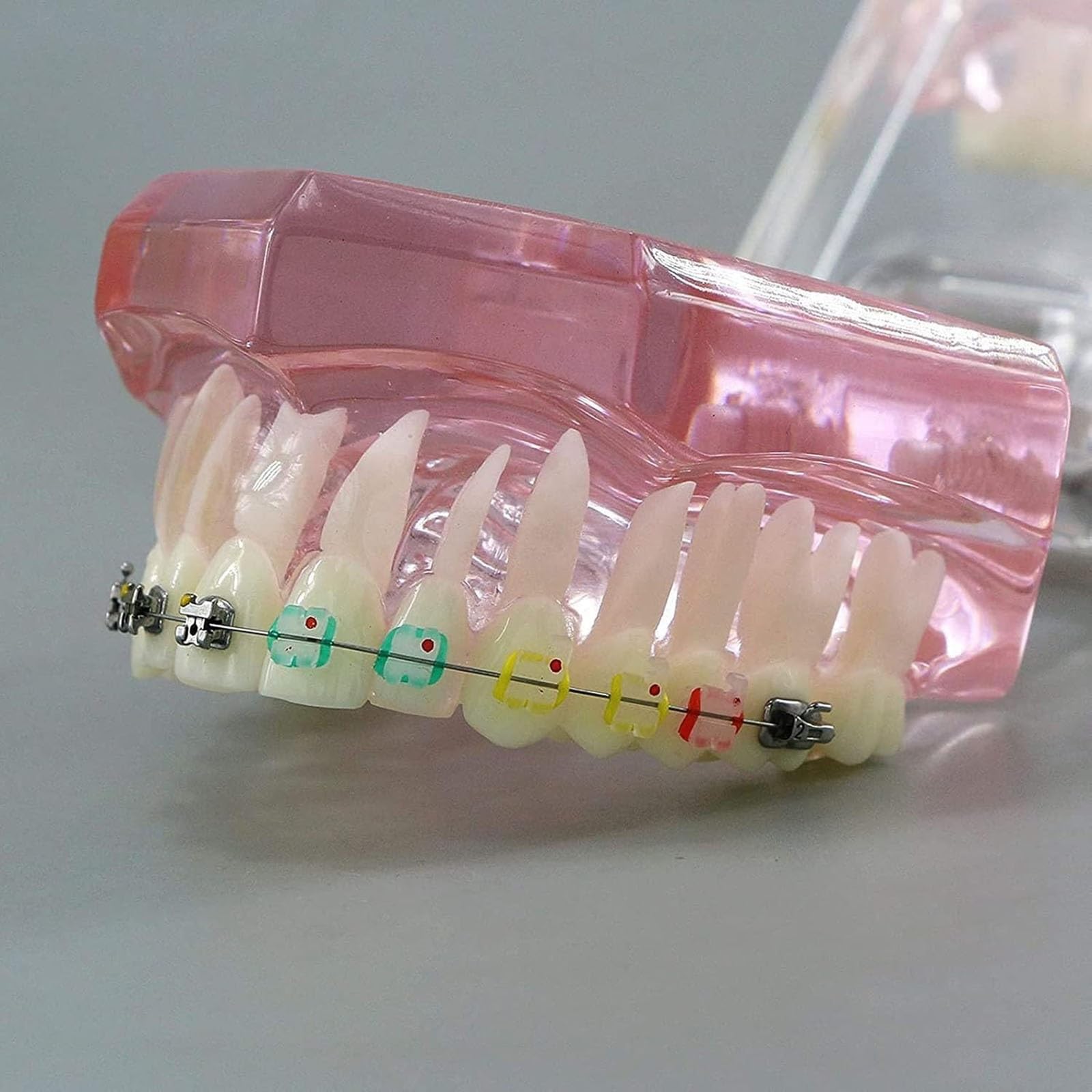 Zahnärztliches kieferorthopädisches Demonstrationsmodell,kieferorthopädisches Retainer-Behandlungsmodell für Zahnzähne mit selbstligierenden Metallklammern,die das Modell erklären