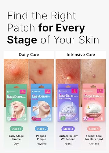 Miniatura 4 de EasyDerm - Juego de parches coreanos para espinillas en 4 pasos + extractor de doble punta 2 en 1, para un cuidado completo de la piel