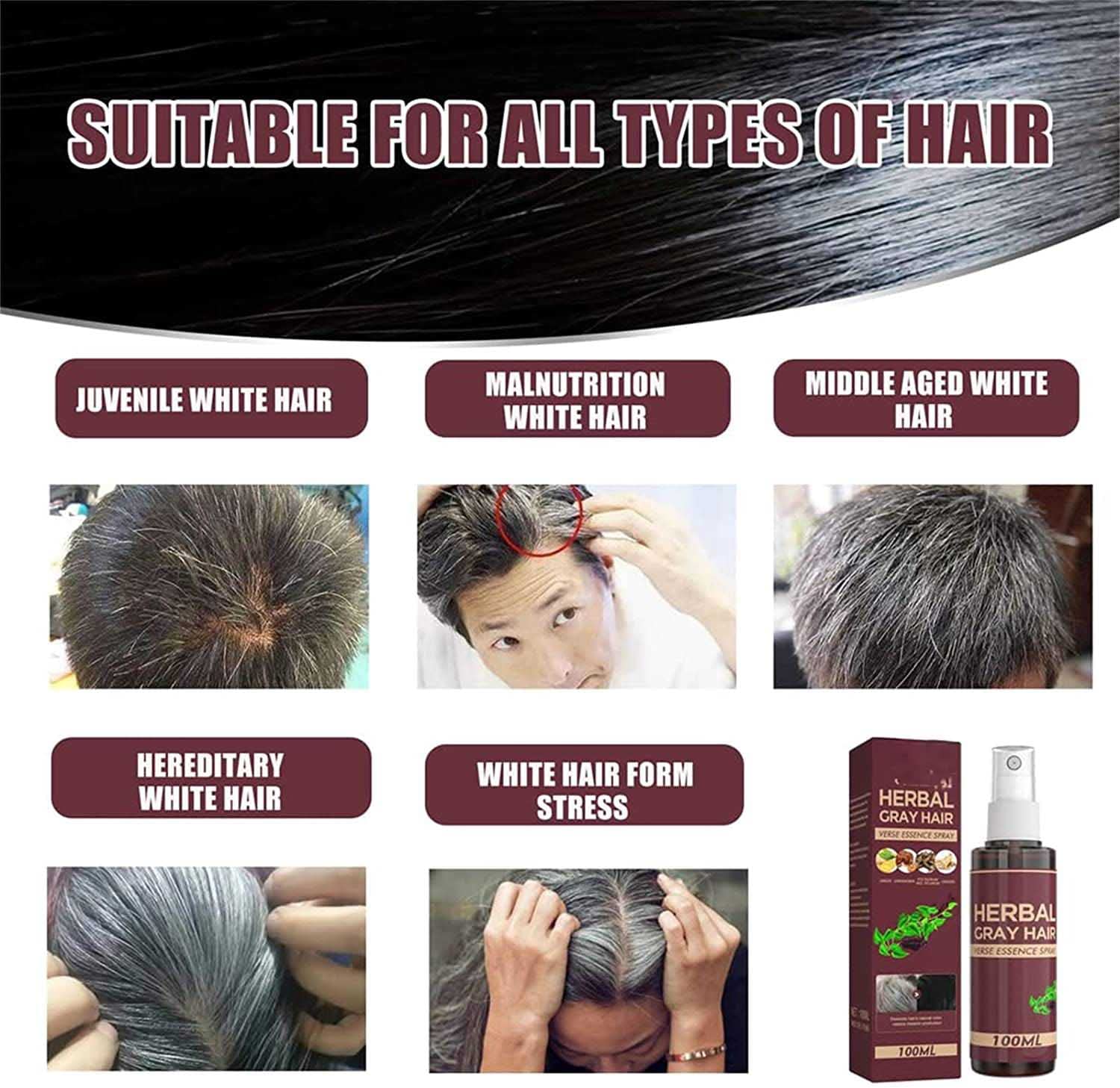Top 100 + How do grey hairs form - polarrunningexpeditions