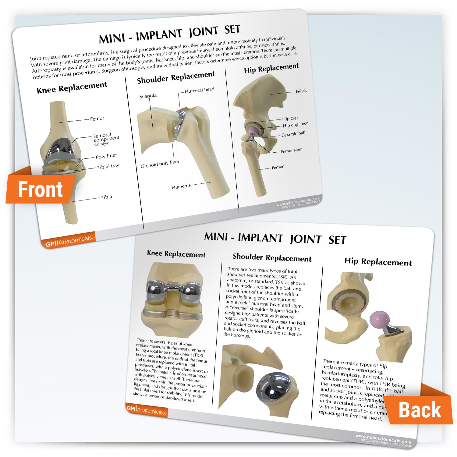 GPI Anatomicals 3-piece Mini Implant Joint Set for Anatomy, Physiology Education, Anatomy Model for Doctor's Offices and Classrooms, Medical Learning Resources