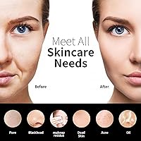 Vista 4 de Cepillo Exfoliante Facial de Silicona, NågraCoola CLIE 2.0 Cepillo de Limpieza Facial, Recargable, Impermeable, Cepillo Exfoliante Facial