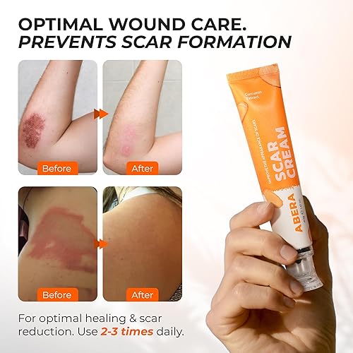 Miniatura 5 de ABERA Crema para cicatrices de cúrcuma roja Protege heridas y regenera la piel dañada Soporta una curación más rápida de heridas de la piel,