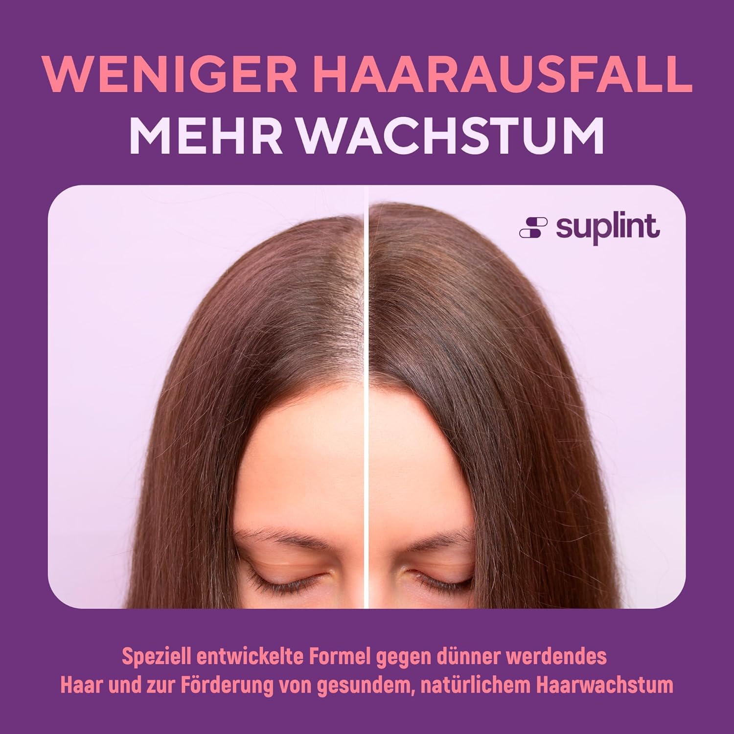Haar Vitamine mit Biotin Hochdosiert 5000 mcg - Haarvitamine Haarausfall mit Zink Selen, Keratin, Vitamin A C D E B12 für Haare, Haut, Nägel - Haarwachstums und Stärkungs Komplex (3 Pack)
