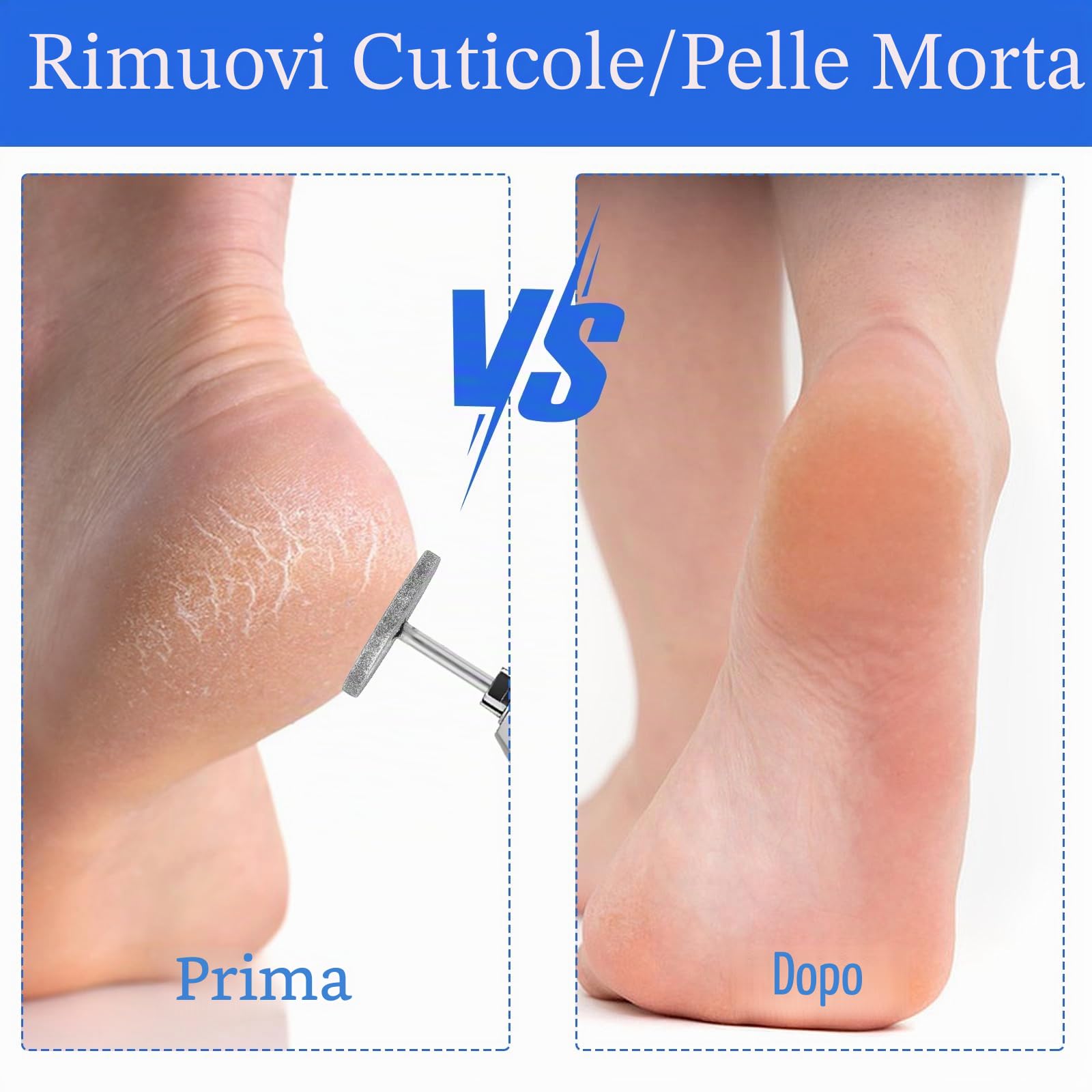 JIEYAO Punte per fresa per unghie, 2 pezzi, disco abrasivo per manicure con 4 levigatrice per piedi da 20 mm, carta vetrata professionale, per pedicure in gel acrilico (#107)