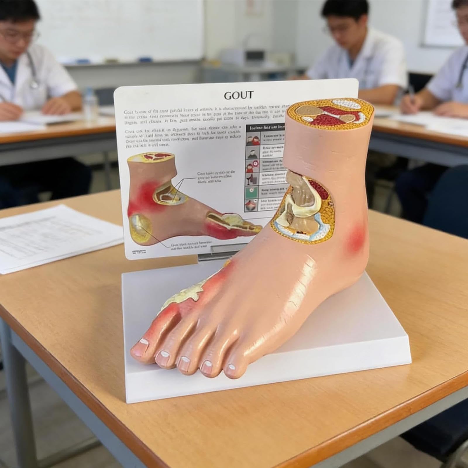 Modelo de patología de pie diabético, herramienta de demostración de complicaciones de gota e hipertensión, modelo anatómico de pie de tamaño real, para enseñar la educación del paciente
