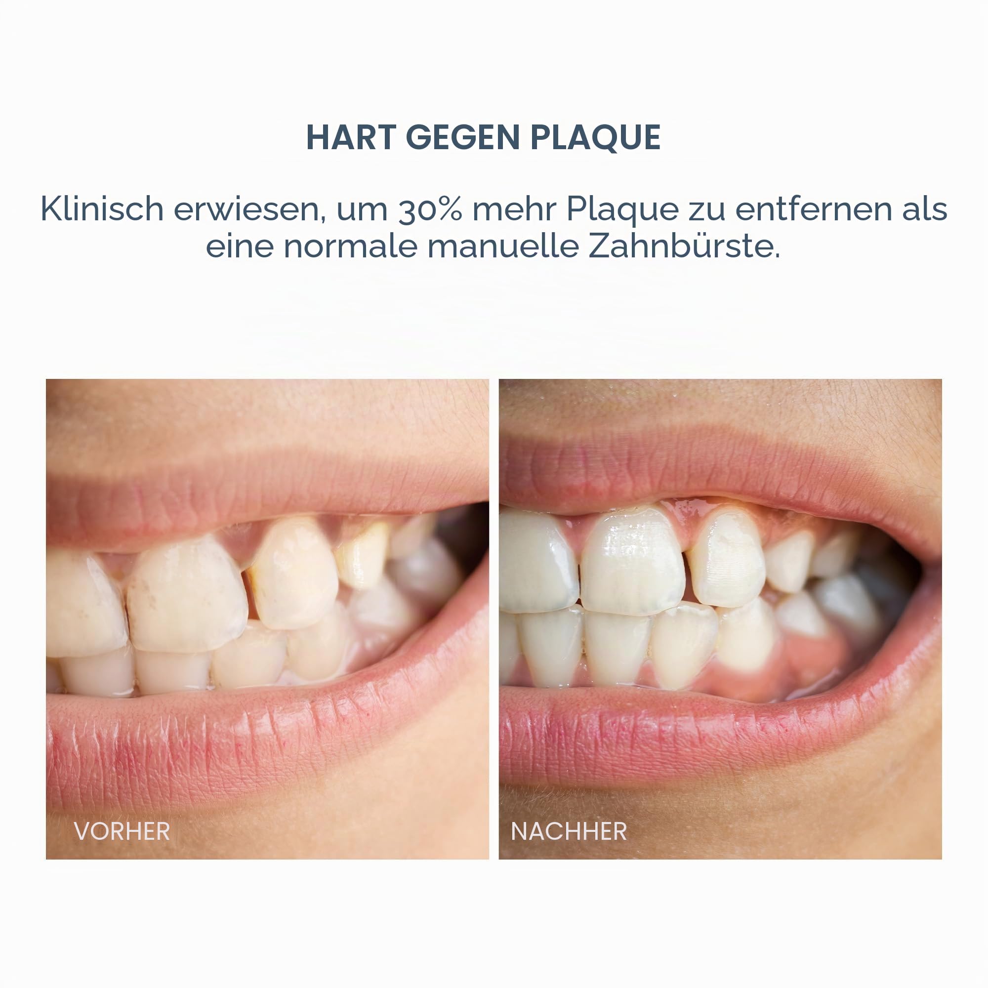 FOREO ISSA 4 Smile – Kompakte Schallzahnbürste für jedes Alter, Violett | Elektrische Zahnbürste, Schallzahnbürste, Weiche Borsten, Zahnfleischpflege, Zungenreiniger, Reisezahnbürste, Aufladbar