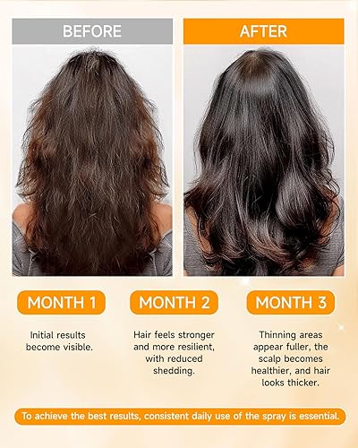 Miniatura 4 de Spray para el crecimiento del cabello, aceite en aerosol para el crecimiento del cabello, con biota orientalis, aceite de romero y biotina,