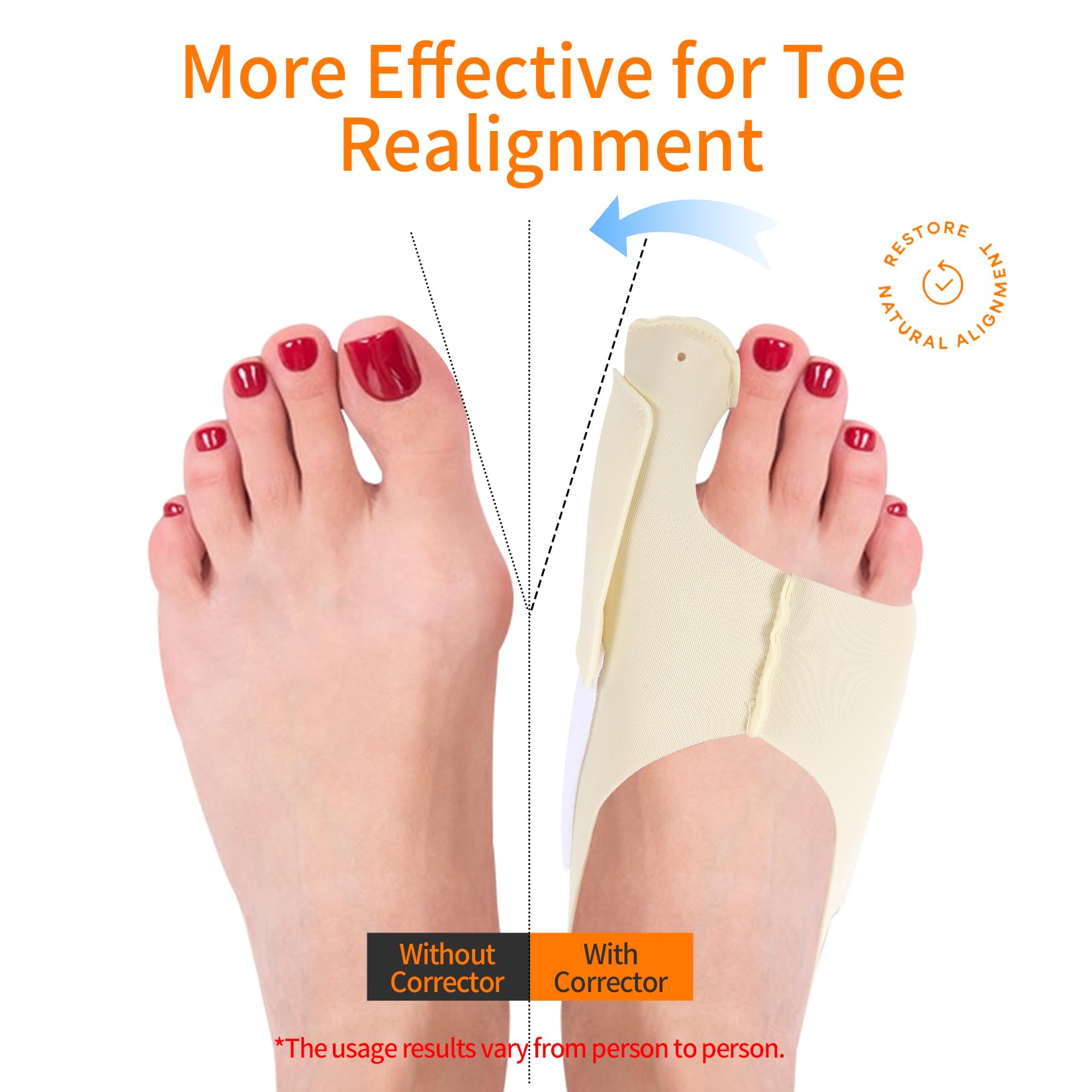 NOWFRESH 2PCS Bunion Corrector for Women & Men - Adjustable Toe Straightener with Customizable Support, Day & Night Wear, Comfortable Toe Separators for Bunion Relief, Thumb Valgus Correction(XL)