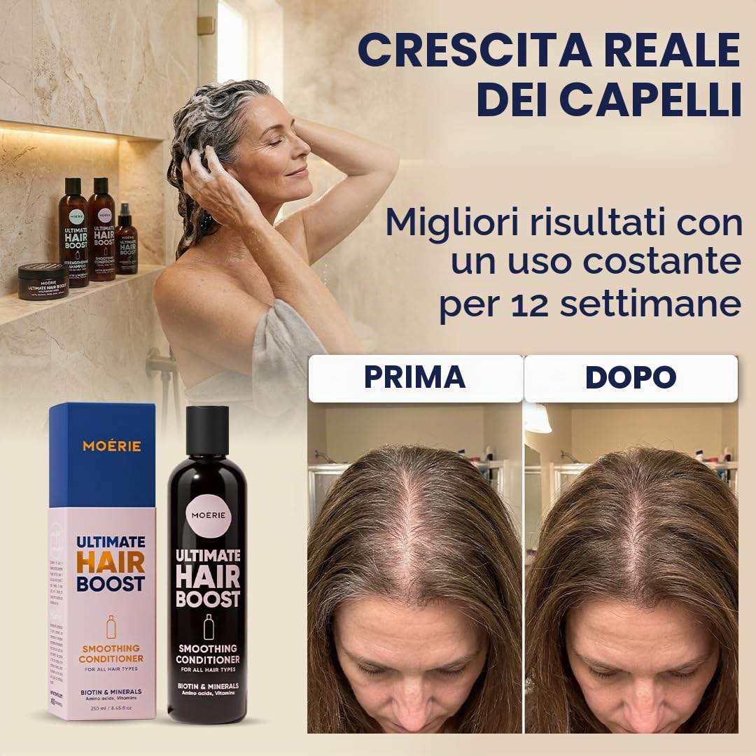 Moerie Balsamo Anti-Caduta Per Capelli Donna E Uomo, Più Lunghi E Pieni, Volumizzante, Vegan Friendly, Senza Parabeni E Silicone, Per Tutti I Capelli, Contro La Caduta Dei Capelli (250 Ml)x2