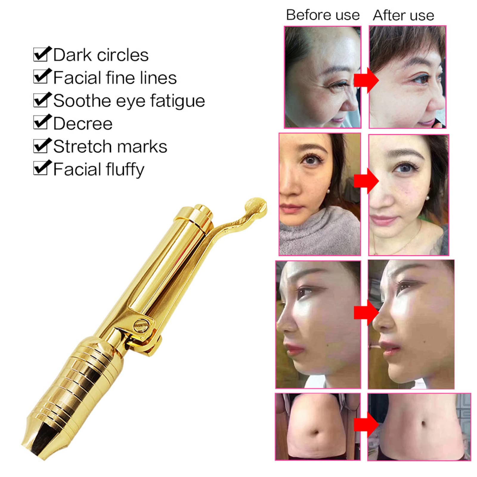 Hyaluronic Acid Pen Kit Hyaluron Micro Iniettore con 5 Testa Fiale Ago Gratuito Iniezione Penna per Sollevamento Pelle Labbra